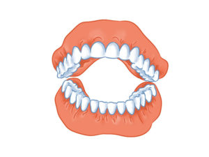 guter Sitz der Zahnprothese